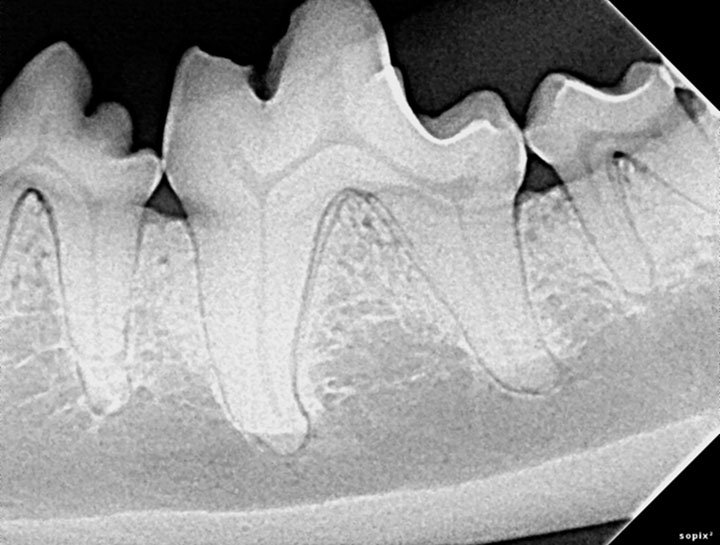 Digital Dental Radiology